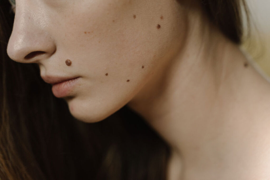 skin-disorder